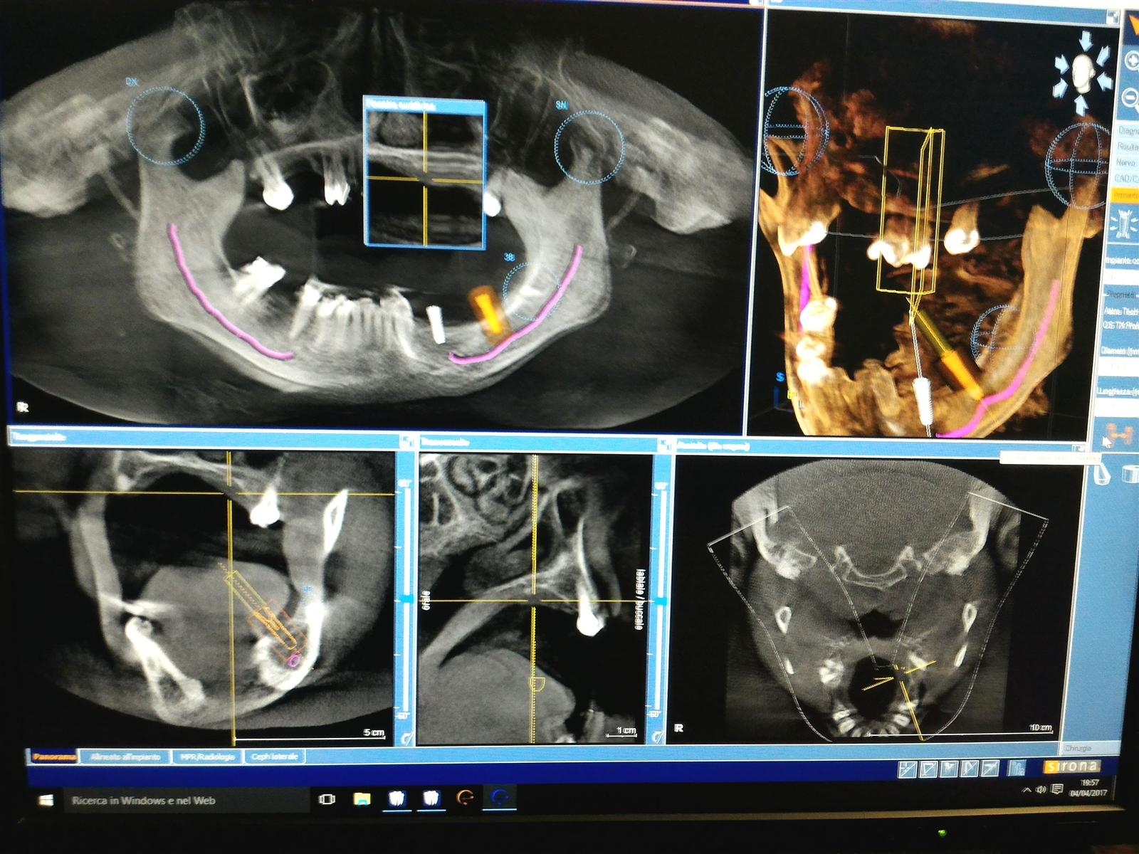 Radiologia-Odontoiatrica